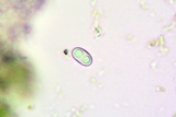 Caloplaca subsoluta image