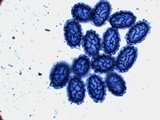 Scutellinia pseudotrechispora image