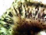 Dimelaena radiata image