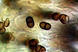 Dimelaena radiata image