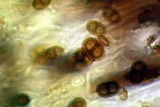 Dimelaena radiata image
