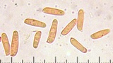Tylopilus rhodoconius image