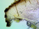 Sarcogyne regularis image