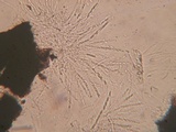 Chaetosphaeria myriocarpa image