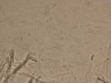 Chaetosphaeria myriocarpa image