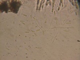 Chaetosphaeria myriocarpa image