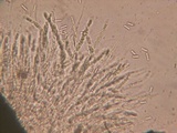 Chaetosphaeria myriocarpa image