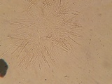 Chaetosphaeria myriocarpa image