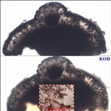 Buellia subdisciformis image
