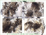 Xanthoriicola physciae image