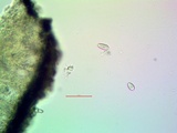 Arthothelium orbilliferum image