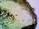 Arthothelium orbilliferum image
