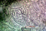 Arthothelium orbilliferum image