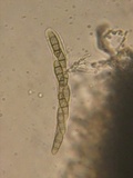 Melanomma pulvis-pyrius image
