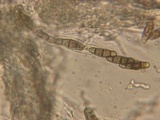 Melanomma pulvis-pyrius image