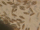 Melanomma pulvis-pyrius image