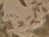 Melanomma pulvis-pyrius image