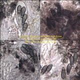 Arthonia elegans image
