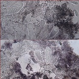 Arthonia cinnabarina image