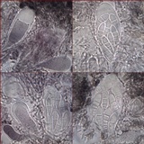 Arthonia cinnabarina image