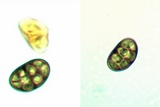 Diplotomma alboatrum image