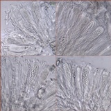 Haematomma sorediatum image