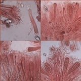Haematomma sorediatum image