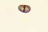 Amandinea punctata image
