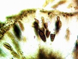 Buellia oidalea image