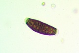 Buellia oidalea image