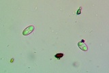 Caloplaca ferruginea image