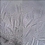 Arthopyrenia cinereopruinosa image