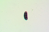 Buellia triseptata image