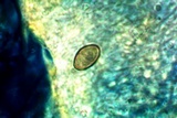 Aspicilia cyanescens image