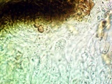 Lichenostigma elongatum image