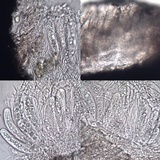 Arthopyrenia analepta image
