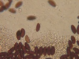 Psathyrella prona image