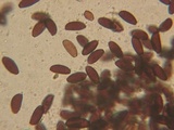 Psathyrella prona image