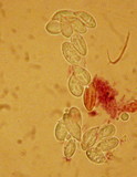 Clitopilus prunulus image