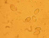 Suillus caerulescens image