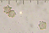 Hydnellum spongiosipes image