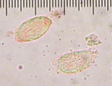 Ramaria formosa image