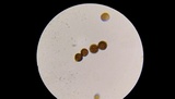 Strobilomyces confusus image