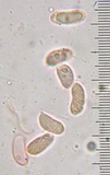 Cantharellus septentrionalis image