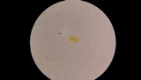Amanita parcivolvata image