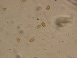 Cortinarius latus image