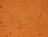 Ramaria stricta image