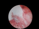 Psathyrella delineata image