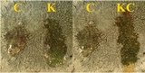 Pertusaria hemisphaerica image