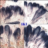 Haematomma sorediatum image